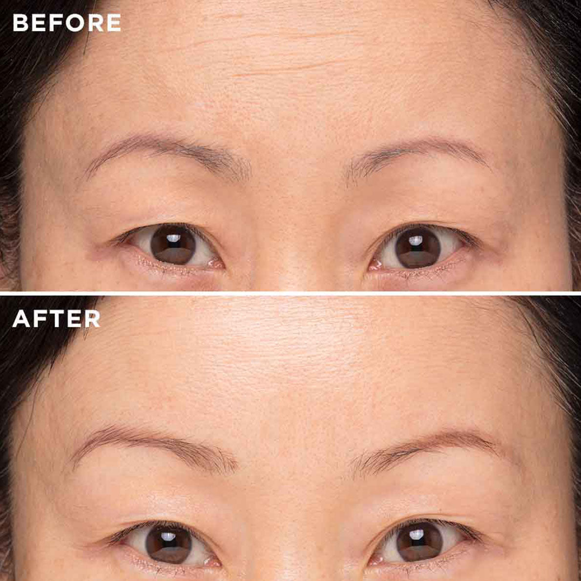 MIE Deep Line Elixir