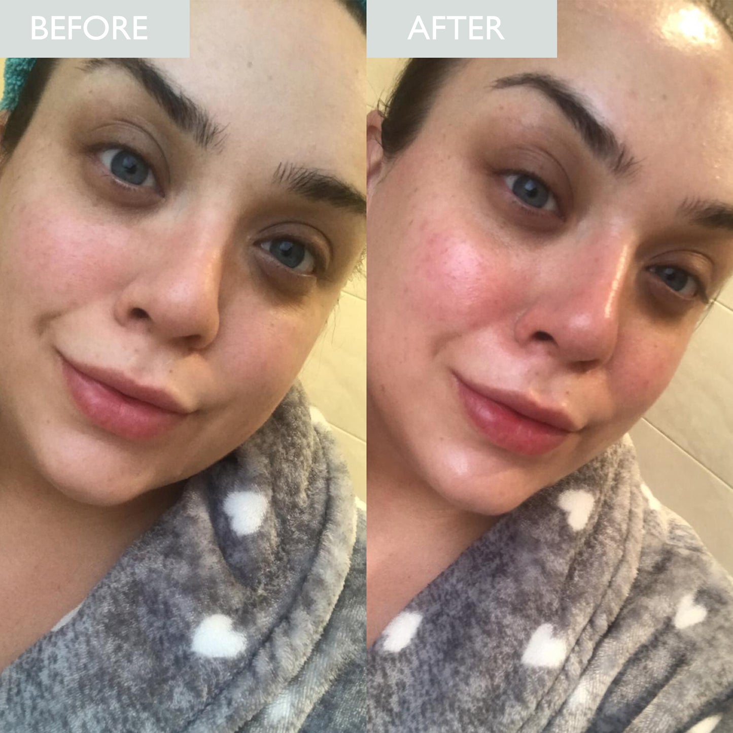 Pro-Radiance Enzyme Peel 50ml
