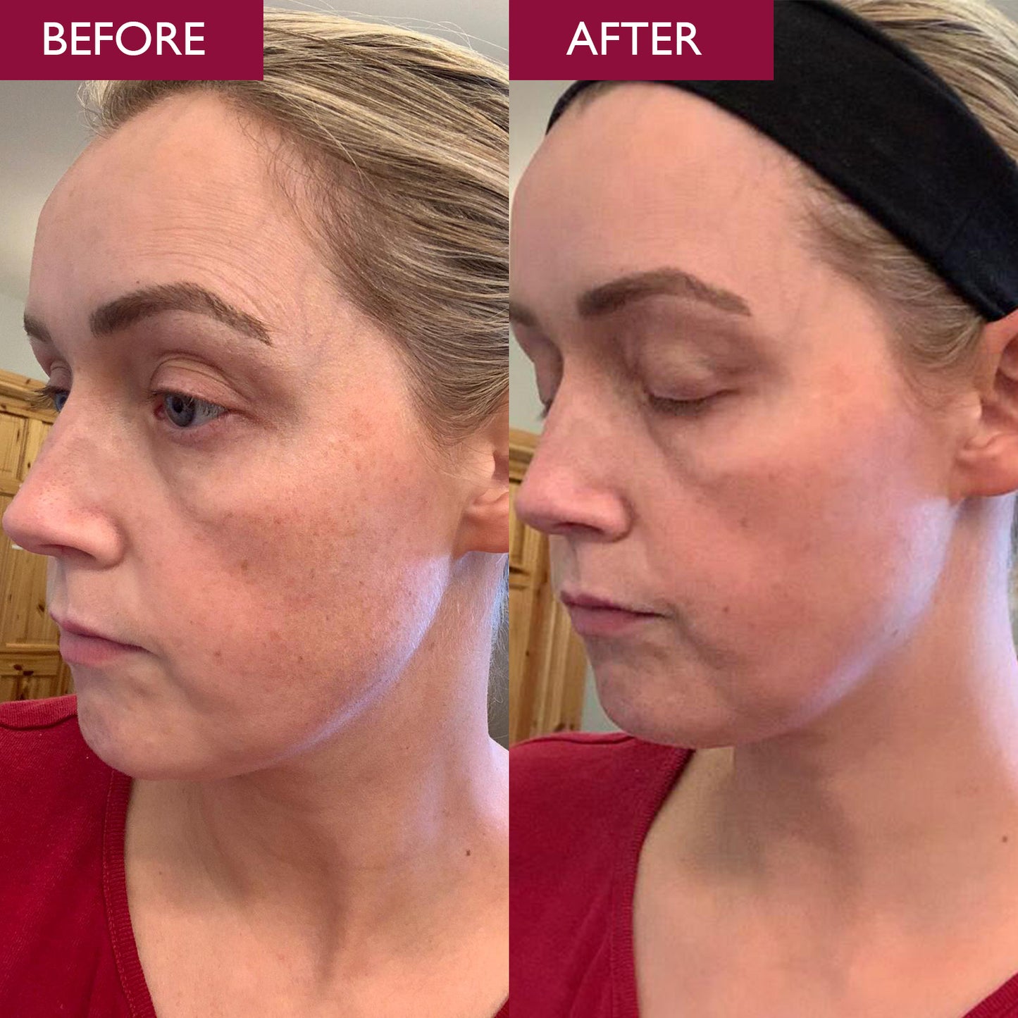 Pro-Radiance Enzyme Cleanser 150ml