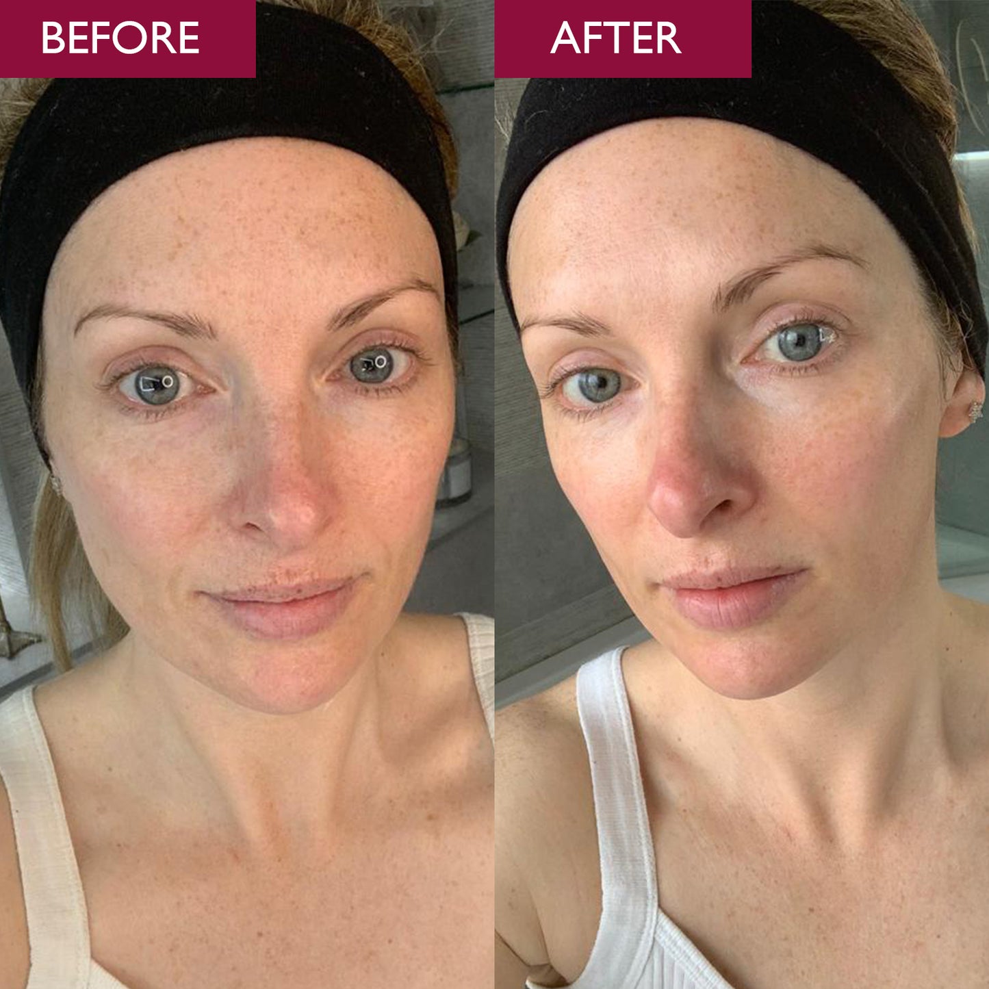 Pro-Radiance Enzyme Peel 50ml
