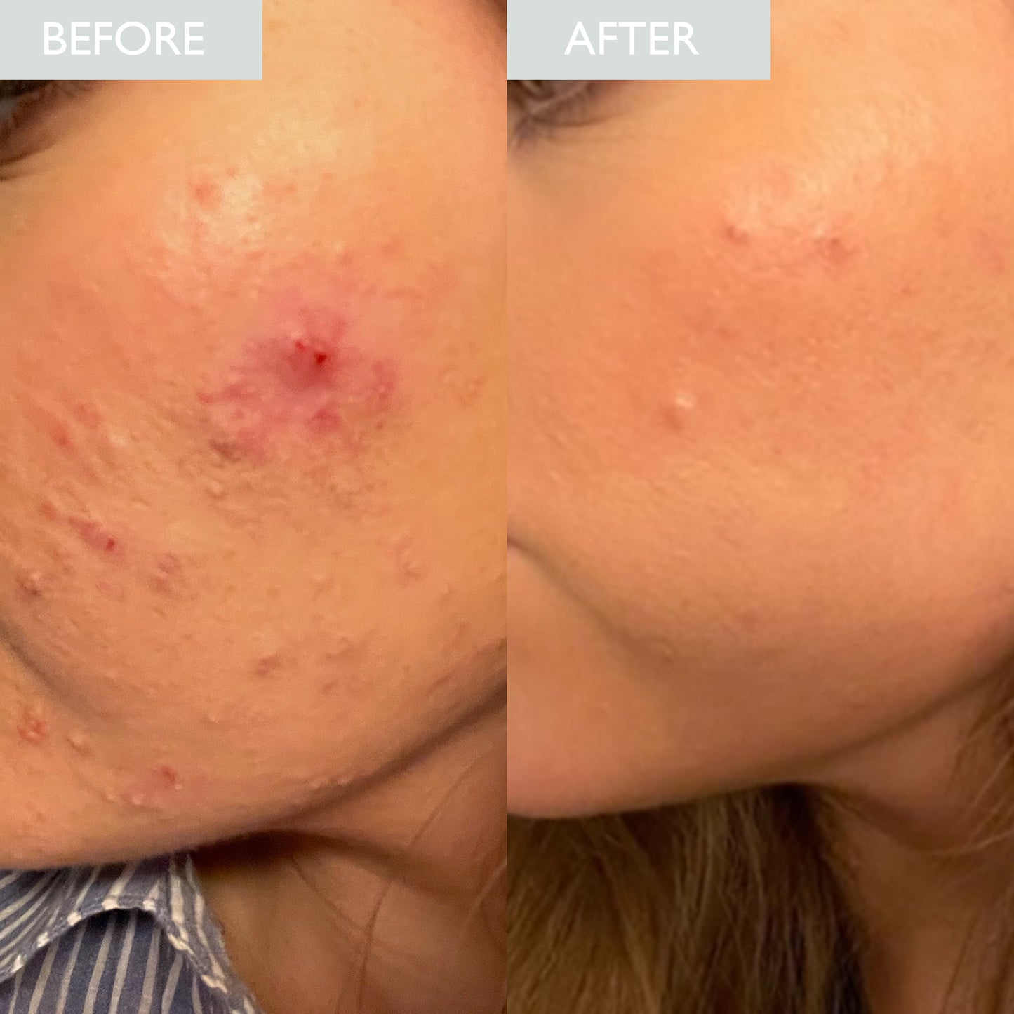 Overnight Retinol Powerbalm LEVEL 1 50ml