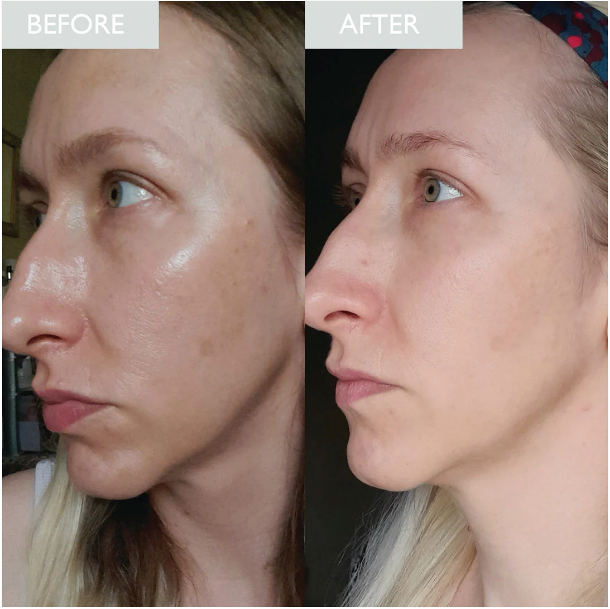 Purifying Daily Moisturiser with SPF 30 for Oily Skin